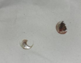 uñas de gato enclavadas